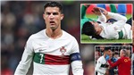 Ronaldo chấn thương, mũi b&#234; bết m&#225;u những vẫn &#39;chiến&#39; hết m&#236;nh c&#249;ng Bồ Đ&#224;o Nha