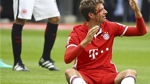 Mueller đổ cả m&#225;u, Bayern Munich vẫn chia điểm thất vọng