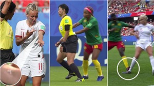 Cho&#225;ng ở World Cup nữ: Cầu thủ Cameroon &#39;phun mưa’, đạp gầm gi&#224;y đối thủ, đẩy ng&#227; trọng t&#224;i, tố FIFA