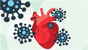 Những điều cần ch&#250; &#253; về sức khỏe tim mạch sau khi mắc COVID-19