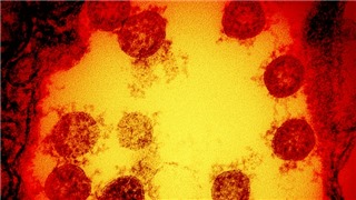  Châu Âu cảnh báo nguy cơ xuất hiện biến thể hoàn toàn mới của virus SARS-CoV-2     