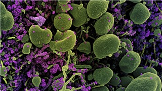  Phát hiện chủng virus SARS-CoV-2 kết hợp giữa 2 biến thể Omicron và Delta 